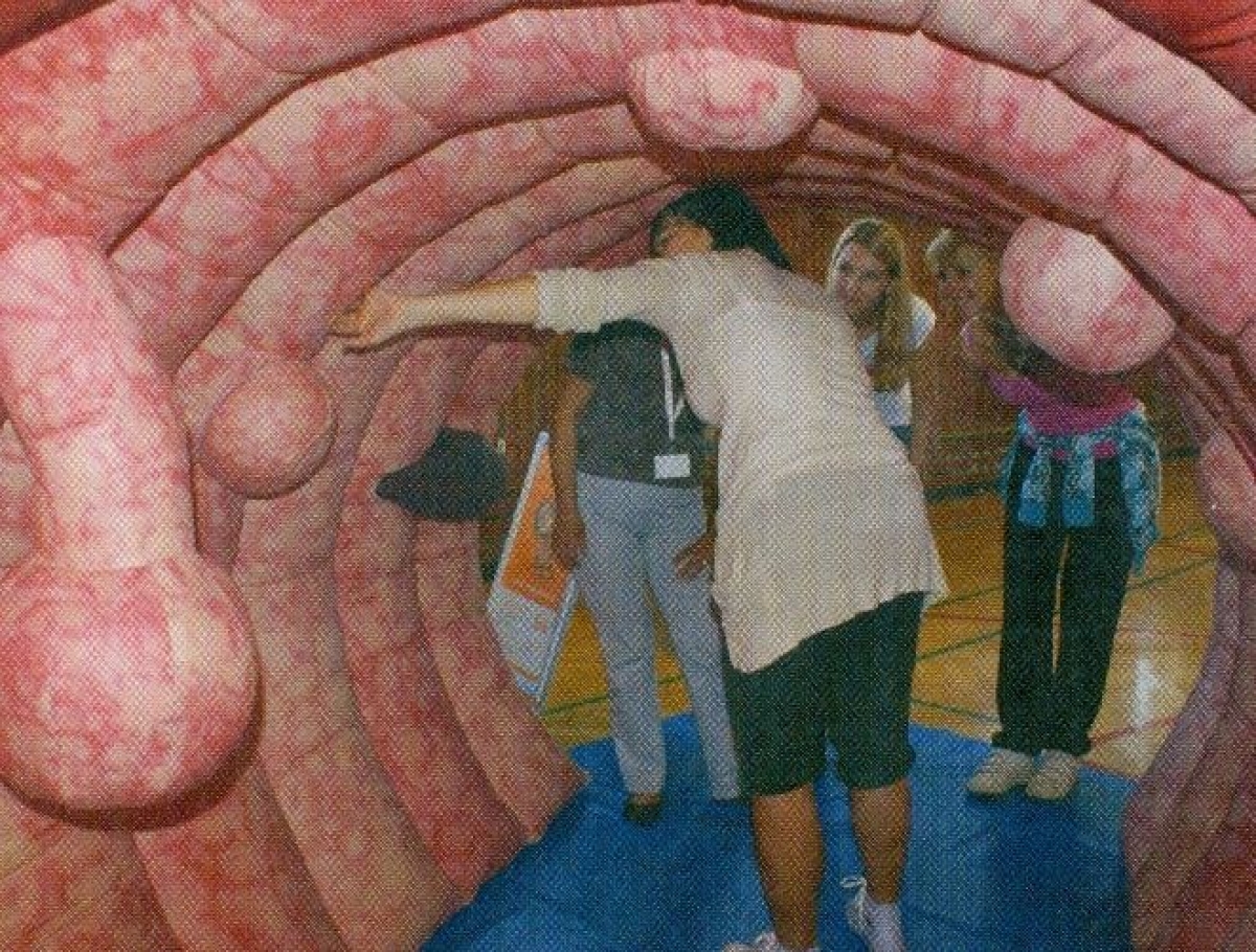 debelo crijevo image debelo crijevo